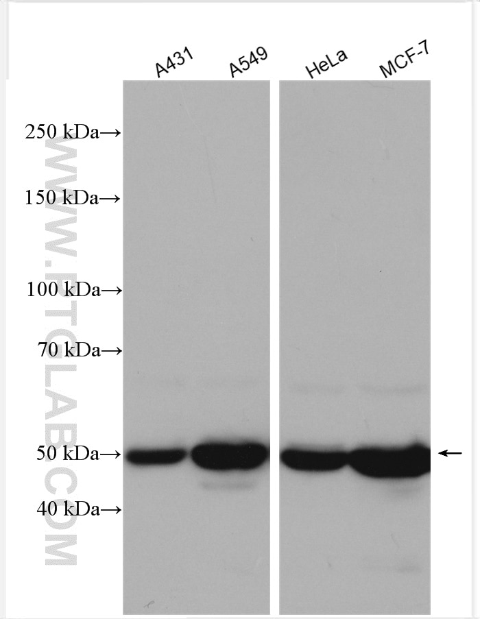 Western Blot (WB) analysis of various lysates using Cytokeratin 8 Polyclonal antibody (17514-1-AP)