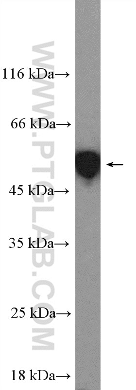 Western Blot (WB) analysis of A549 cells using Cytokeratin 8 Polyclonal antibody (17514-1-AP)