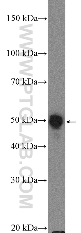 Cytokeratin 8 Polyclonal antibody