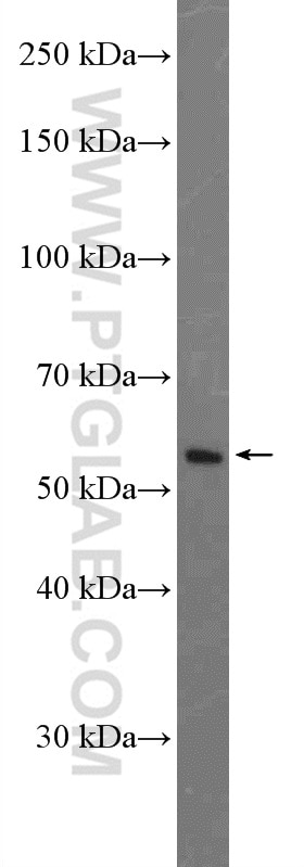 Western Blot (WB) analysis of C6 cells using Cytokeratin 8 Polyclonal antibody (17514-1-AP)