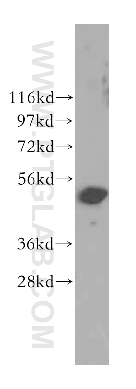 Western Blot (WB) analysis of A549 cells using Cytokeratin 8 Polyclonal antibody (17514-1-AP)