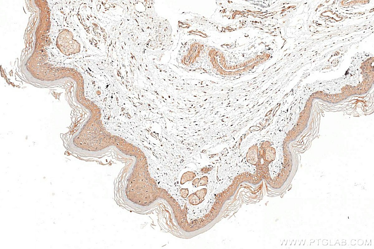Immunohistochemistry (IHC) staining of mouse skin tissue using Cytokeratin 80 Polyclonal antibody (16835-1-AP)