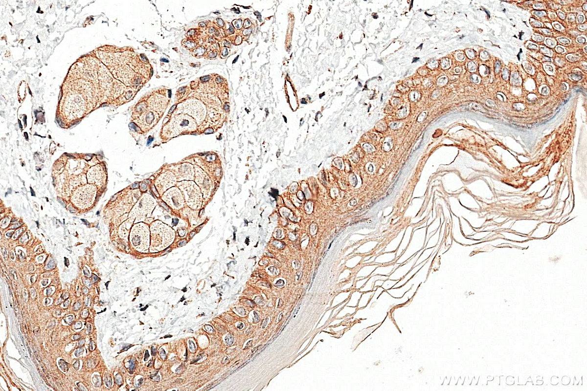Immunohistochemistry (IHC) staining of mouse skin tissue using Cytokeratin 80 Polyclonal antibody (16835-1-AP)