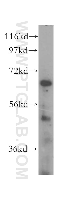 Western Blot (WB) analysis of human skeletal muscle tissue using KRT80 Polyclonal antibody (16835-1-AP)