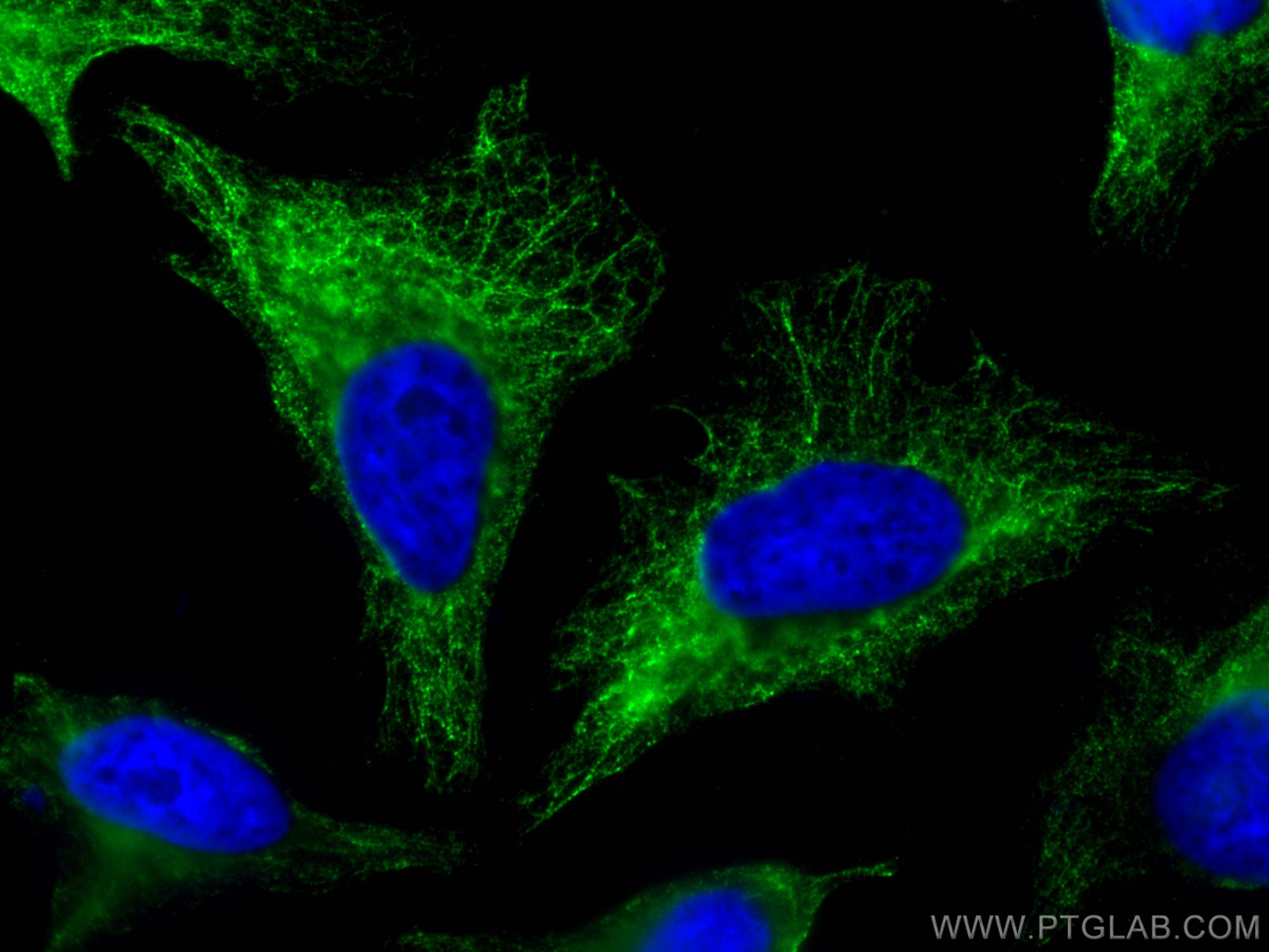 Immunofluorescence (IF) / fluorescent staining of HeLa cells using Cytokeratin 81 Polyclonal antibody (11342-1-AP)