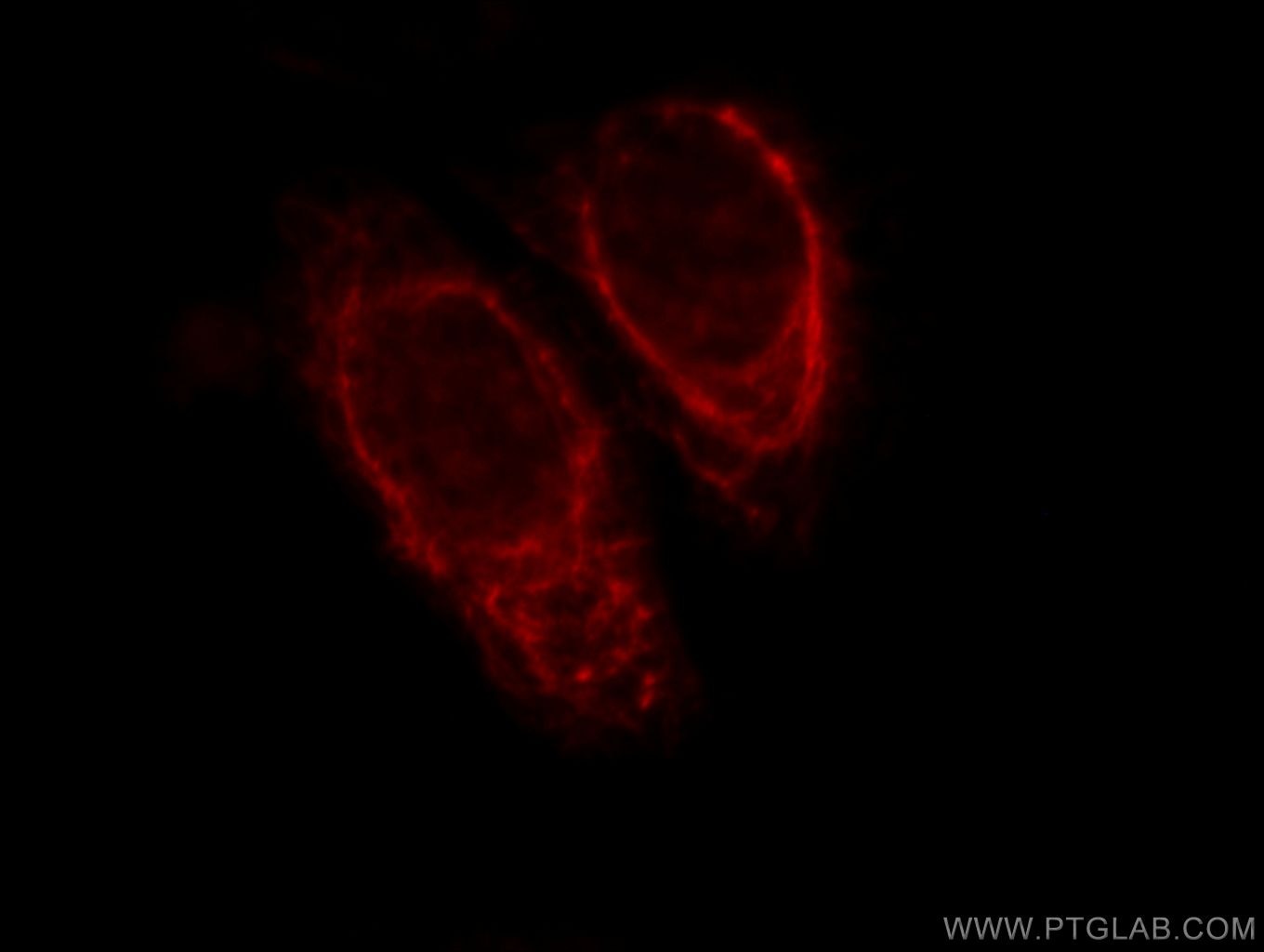 Immunofluorescence (IF) / fluorescent staining of HepG2 cells using KRT81 Polyclonal antibody (11342-1-AP)