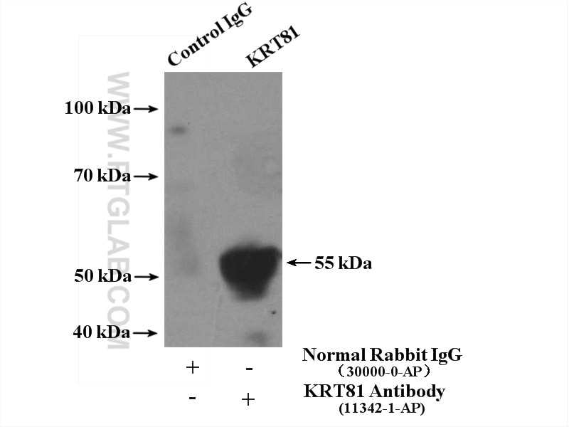 Immunoprecipitation (IP) experiment of HEK-293 cells using KRT81 Polyclonal antibody (11342-1-AP)