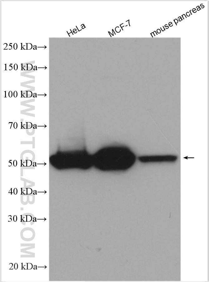 Western Blot (WB) analysis of various lysates using KRT81 Polyclonal antibody (11342-1-AP)