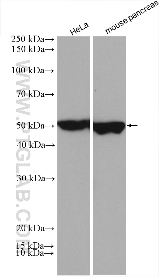 Western Blot (WB) analysis of various lysates using KRT81 Polyclonal antibody (11342-1-AP)