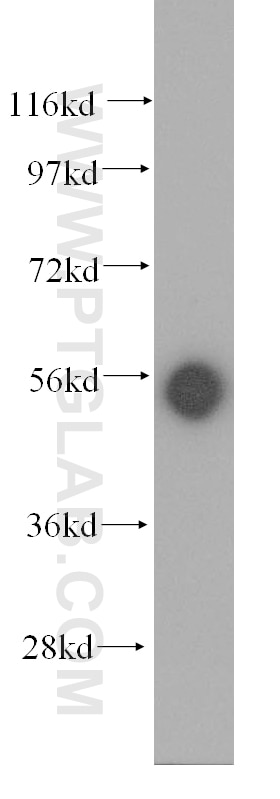 Western Blot (WB) analysis of mouse thymus tissue using KRT81 Polyclonal antibody (11342-1-AP)