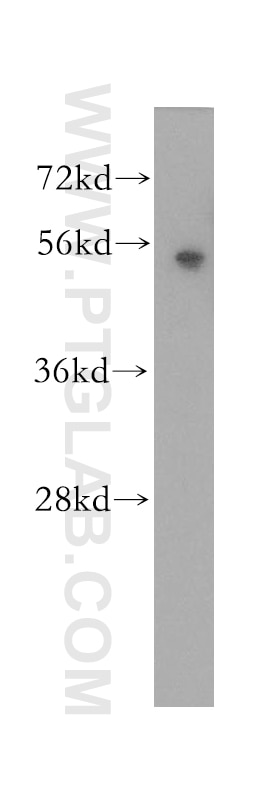Western Blot (WB) analysis of human spleen tissue using KRT81 Polyclonal antibody (11342-1-AP)