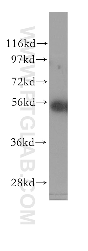 Western Blot (WB) analysis of HEK-293 cells using KRT81 Polyclonal antibody (11342-1-AP)