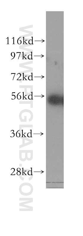 WB analysis of HEK-293 using 11342-1-AP