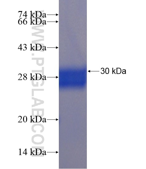 KRT82 fusion protein Ag20179 SDS-PAGE