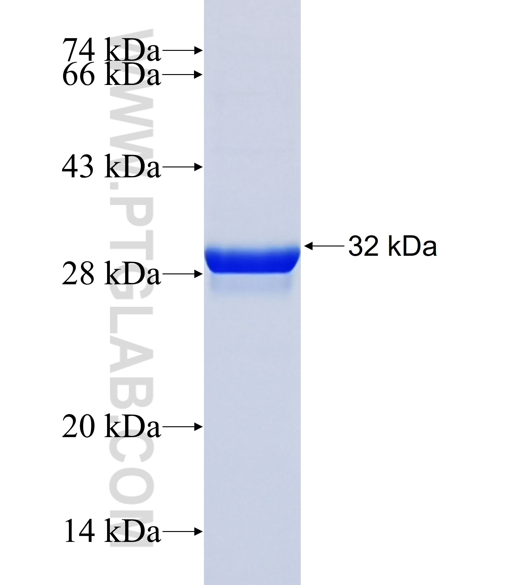KRT83 fusion protein Ag38130 SDS-PAGE KRT83 fusion protein Ag38130 SDS-PAGE