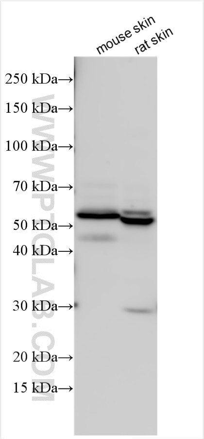 Western Blot (WB) analysis of various lysates using KRT86 Polyclonal antibody (26012-1-AP)