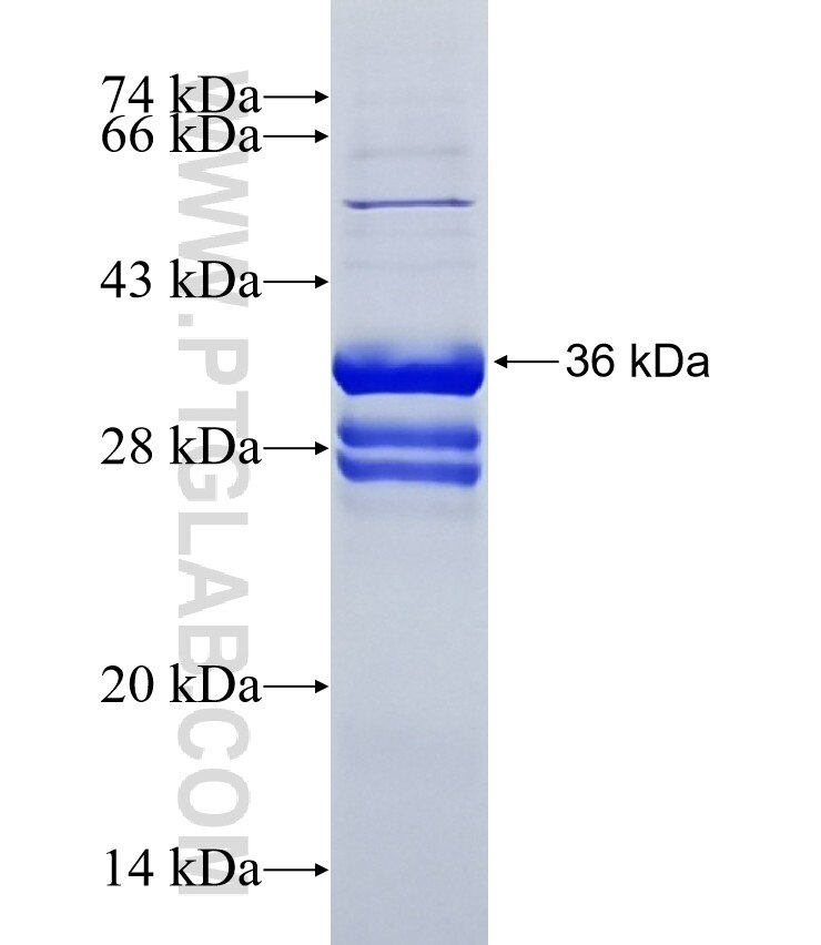 KRTAP3-2 fusion protein Ag11494 SDS-PAGE