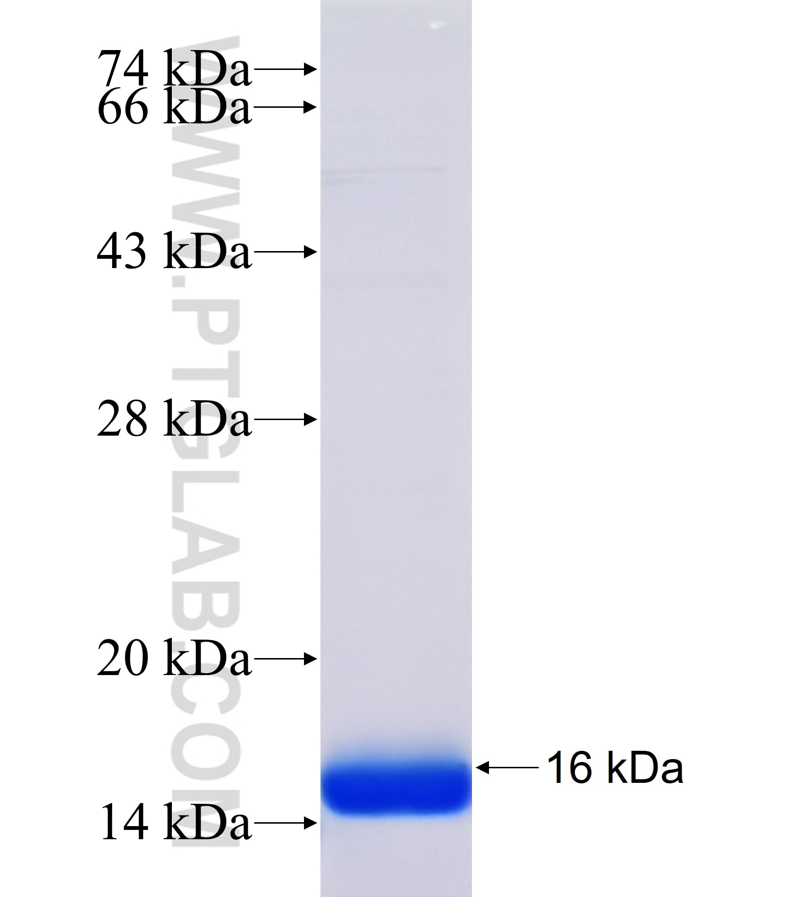 KRTDAP fusion protein Ag37899 SDS-PAGE KRTDAP fusion protein Ag37899 SDS-PAGE