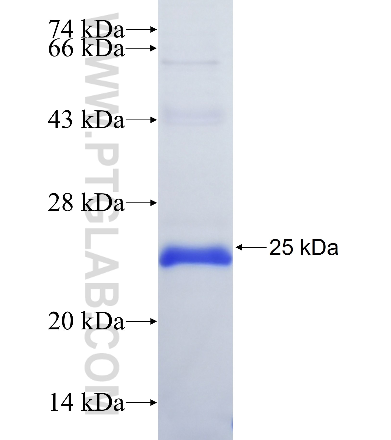 KSR2 fusion protein Ag37155 SDS-PAGE KSR2 fusion protein Ag37155 SDS-PAGE