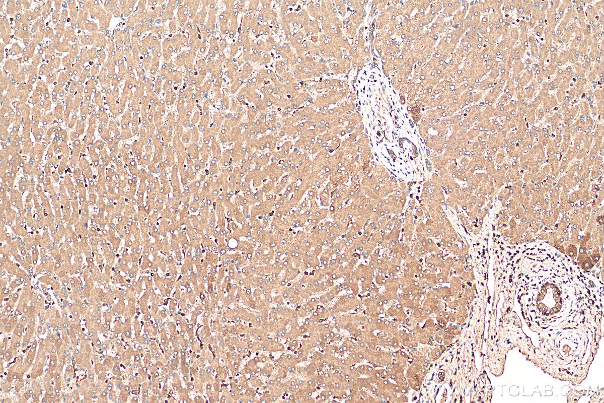 Immunohistochemistry (IHC) staining of human liver tissue using KTELC1 Polyclonal antibody (24409-1-AP)