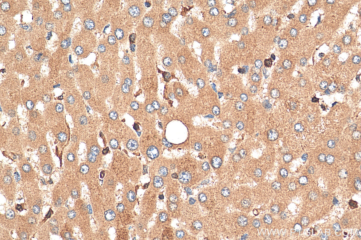 Immunohistochemistry (IHC) staining of human liver tissue using KTELC1 Polyclonal antibody (24409-1-AP)