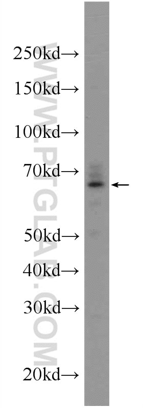Western Blot (WB) analysis of HepG2 cells using KTELC1 Polyclonal antibody (24409-1-AP)