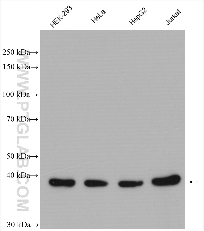 Western Blot (WB) analysis of various lysates using KTI12 Polyclonal antibody (28237-1-AP)