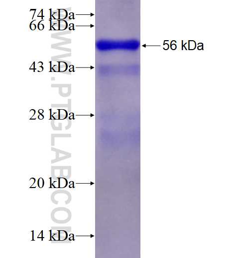 KTI12 fusion protein Ag28201 SDS-PAGE