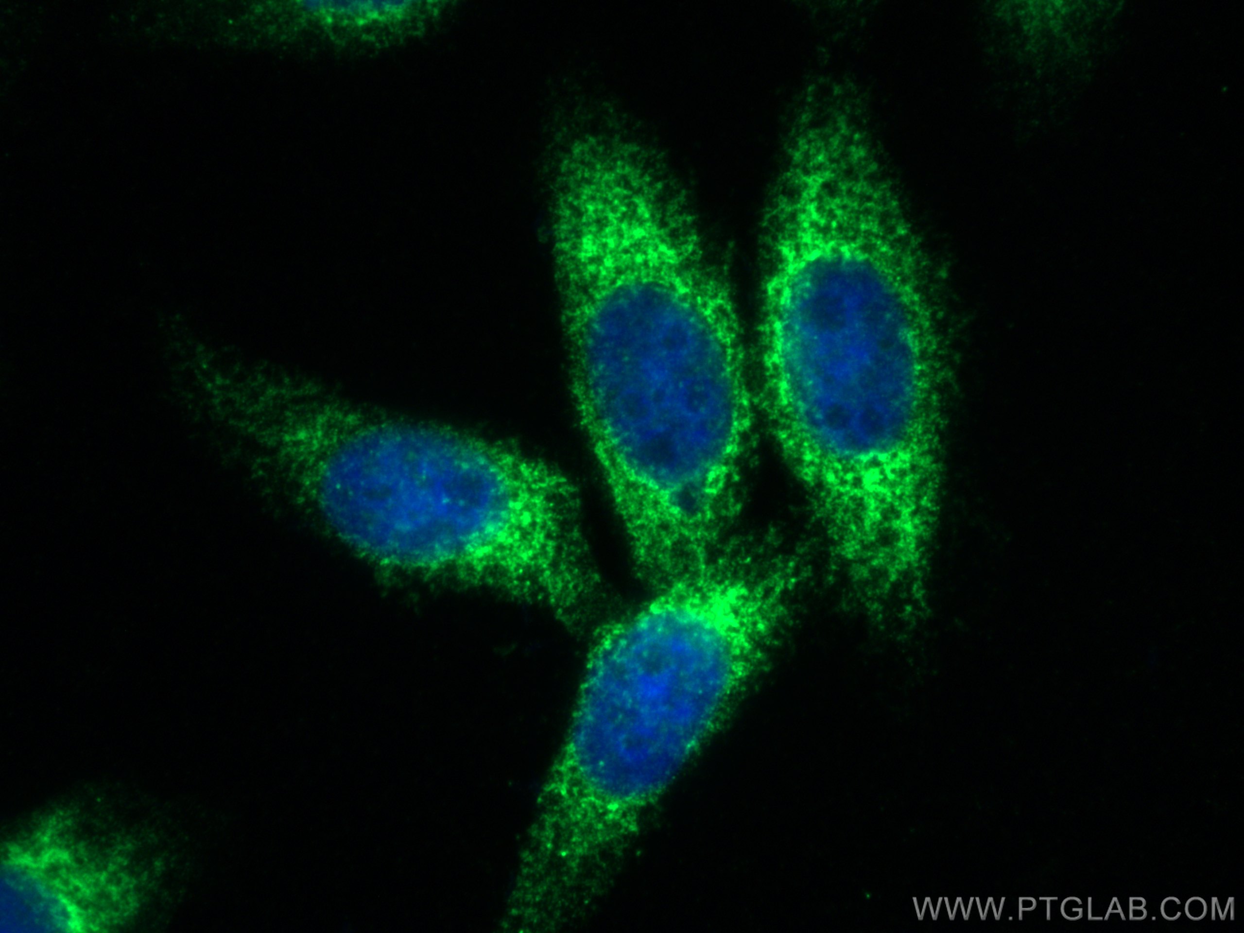 Immunofluorescence (IF) / fluorescent staining of HepG2 cells using KTN1 Polyclonal antibody (19841-1-AP)