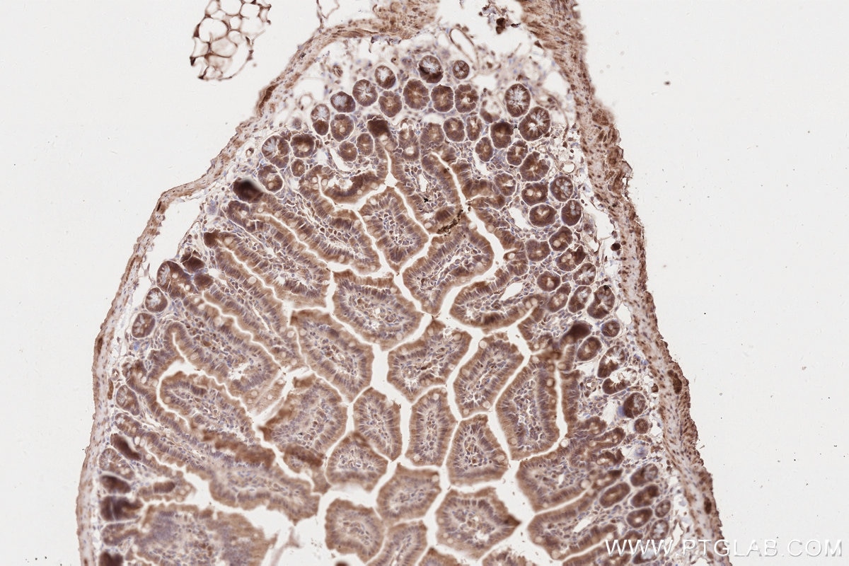 Immunohistochemistry (IHC) staining of mouse small intestine tissue using KTN1 Polyclonal antibody (19841-1-AP)
