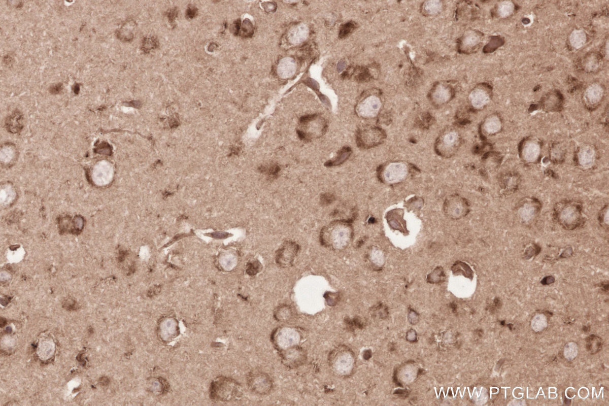 Immunohistochemistry (IHC) staining of mouse brain tissue using KTN1 Polyclonal antibody (19841-1-AP)