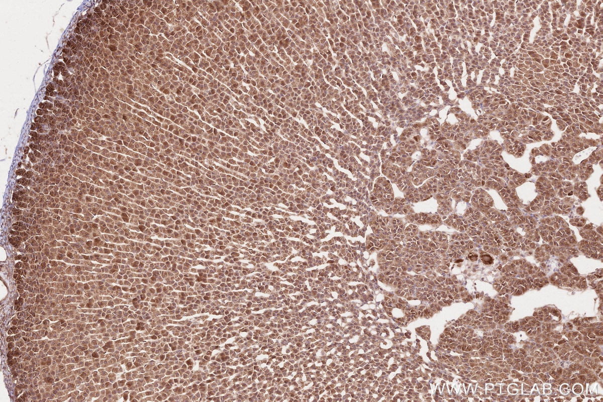 Immunohistochemistry (IHC) staining of rat adrenal gland tissue using KTN1 Polyclonal antibody (19841-1-AP)