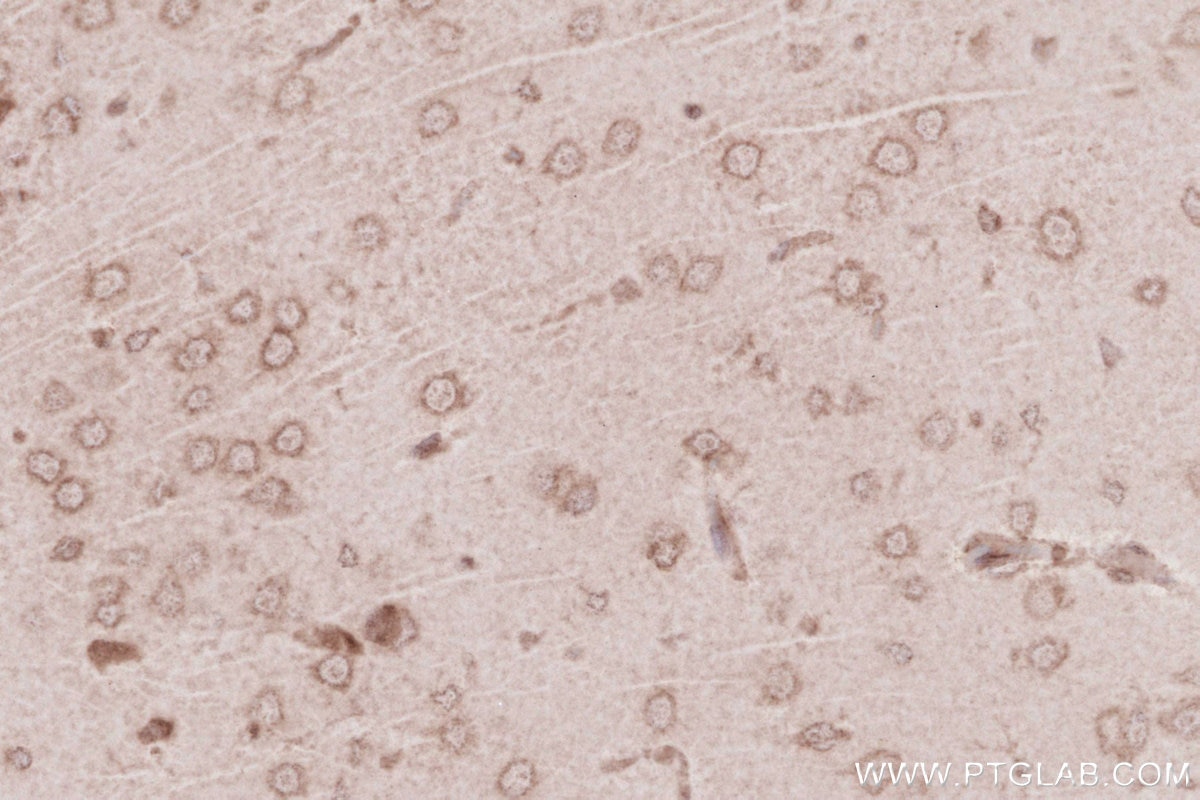 Immunohistochemistry (IHC) staining of rat brain tissue using KTN1 Polyclonal antibody (19841-1-AP)