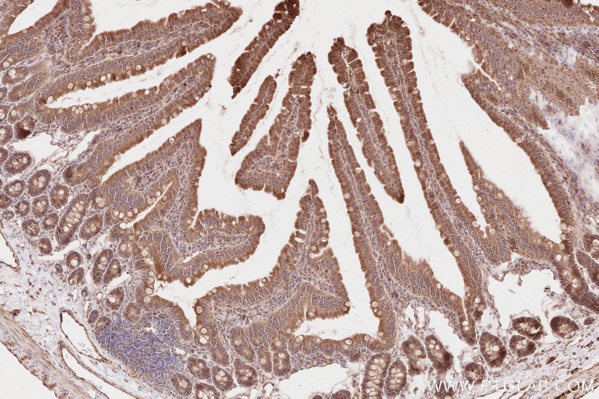 Immunohistochemistry (IHC) staining of rat small intestine tissue using KTN1 Polyclonal antibody (19841-1-AP)