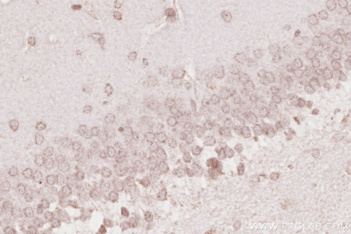 Immunohistochemistry (IHC) staining of rat brain tissue using KTN1 Polyclonal antibody (19841-1-AP)
