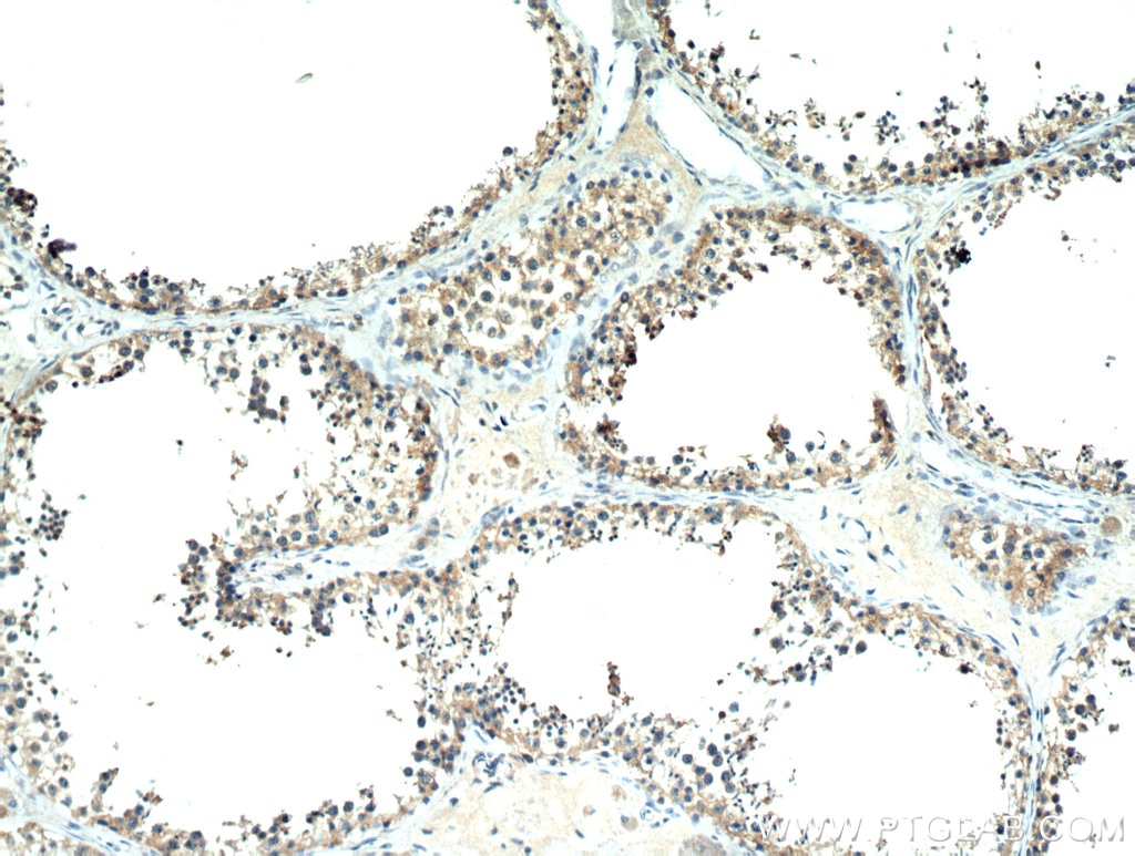 Immunohistochemistry (IHC) staining of human testis tissue using KTN1 Polyclonal antibody (19841-1-AP)