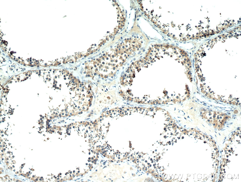 IHC staining of human testis using 19841-1-AP