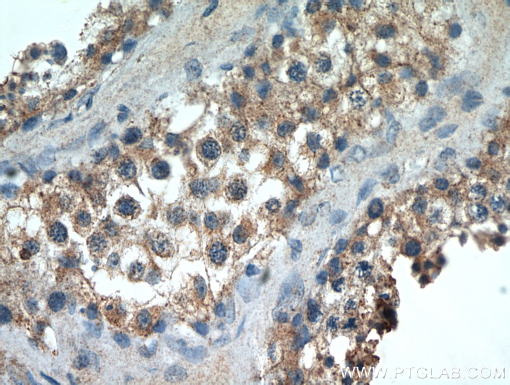 IHC staining of human testis using 19841-1-AP