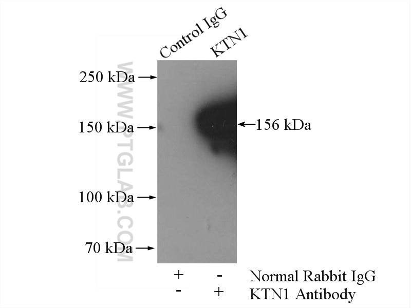 Immunoprecipitation (IP) experiment of Jurkat cells using KTN1 Polyclonal antibody (19841-1-AP)