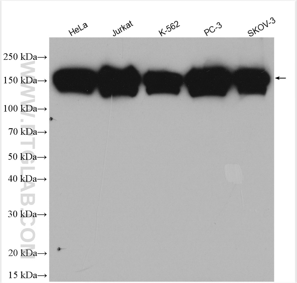 Western Blot (WB) analysis of various lysates using KTN1 Polyclonal antibody (19841-1-AP)