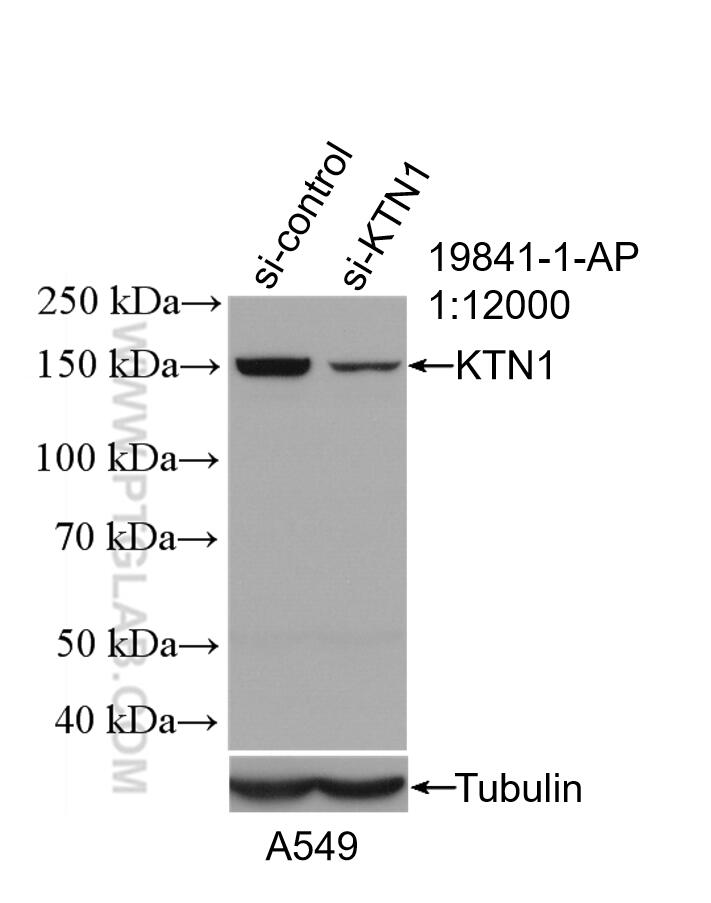 Western Blot (WB) analysis of A549 cells using KTN1 Polyclonal antibody (19841-1-AP)