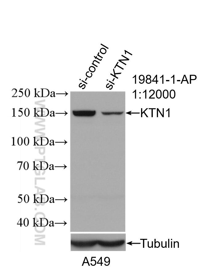 WB analysis of A549 using 19841-1-AP