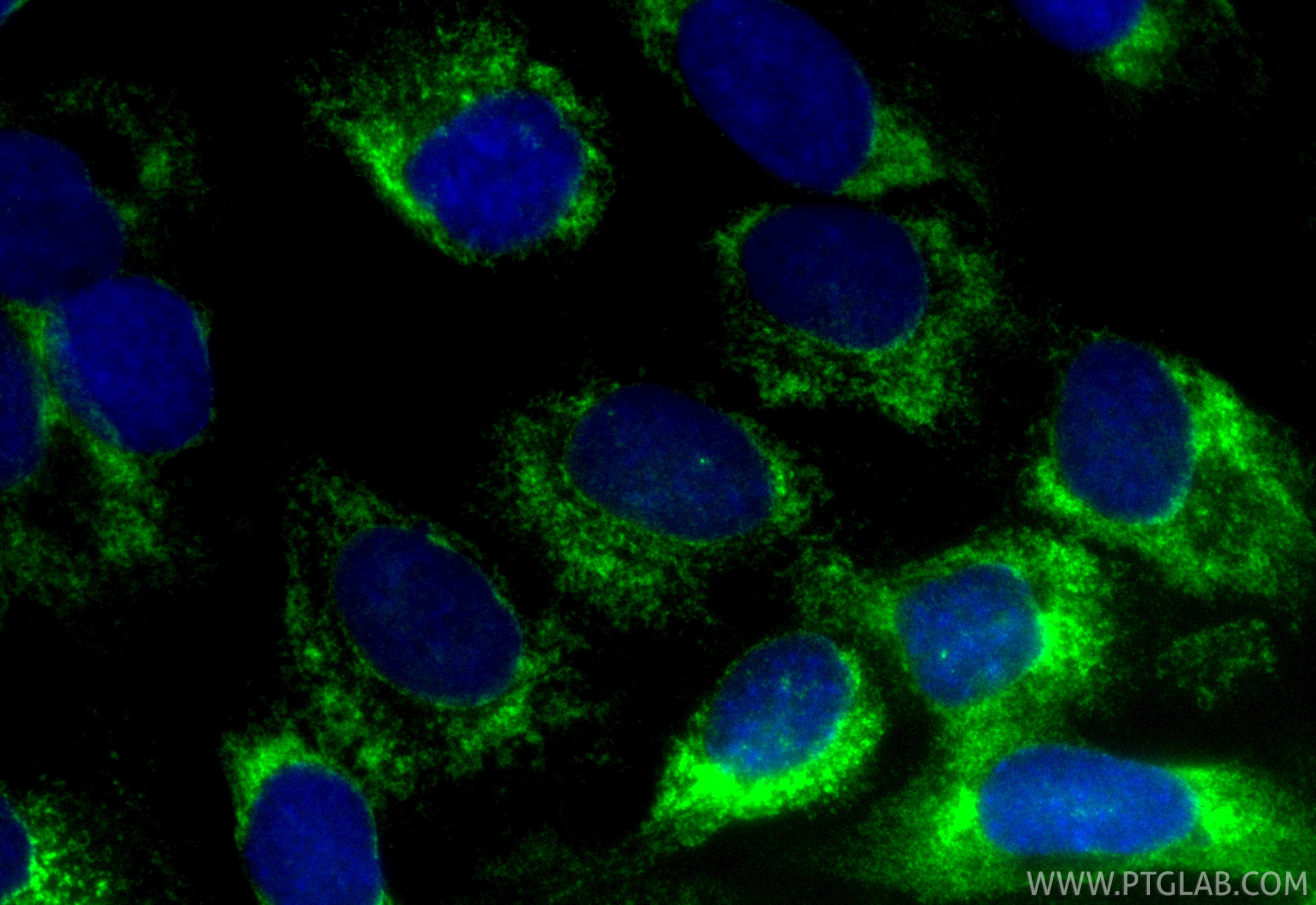 Immunofluorescence (IF) / fluorescent staining of SKOV-3 cells using CoraLite® Plus 488-conjugated KTN1 Recombinant ant (CL488-85681-4)