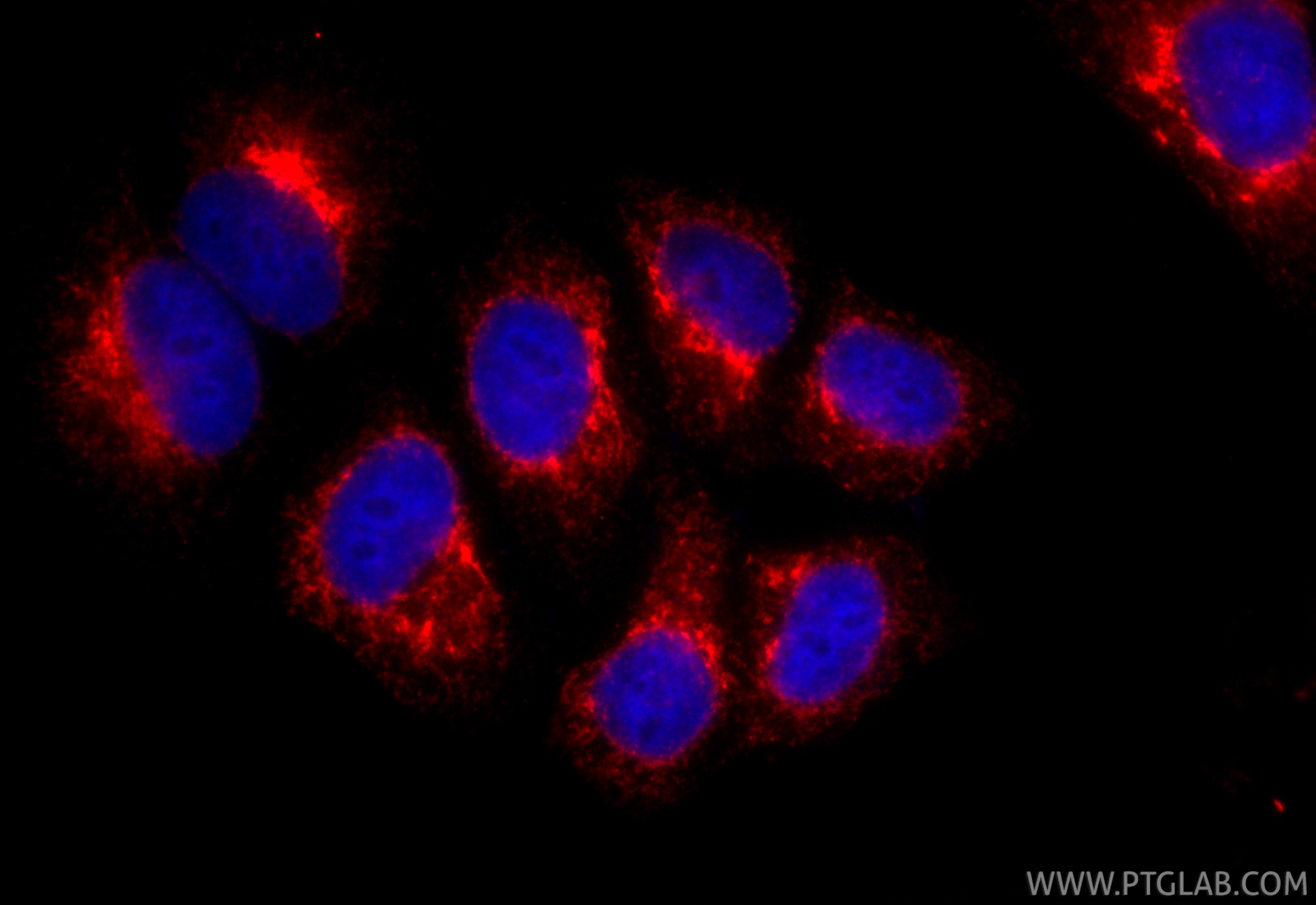 Immunofluorescence (IF) / fluorescent staining of HepG2 cells using CoraLite®594-conjugated KTN1 Recombinant antibody (CL594-85681-4)