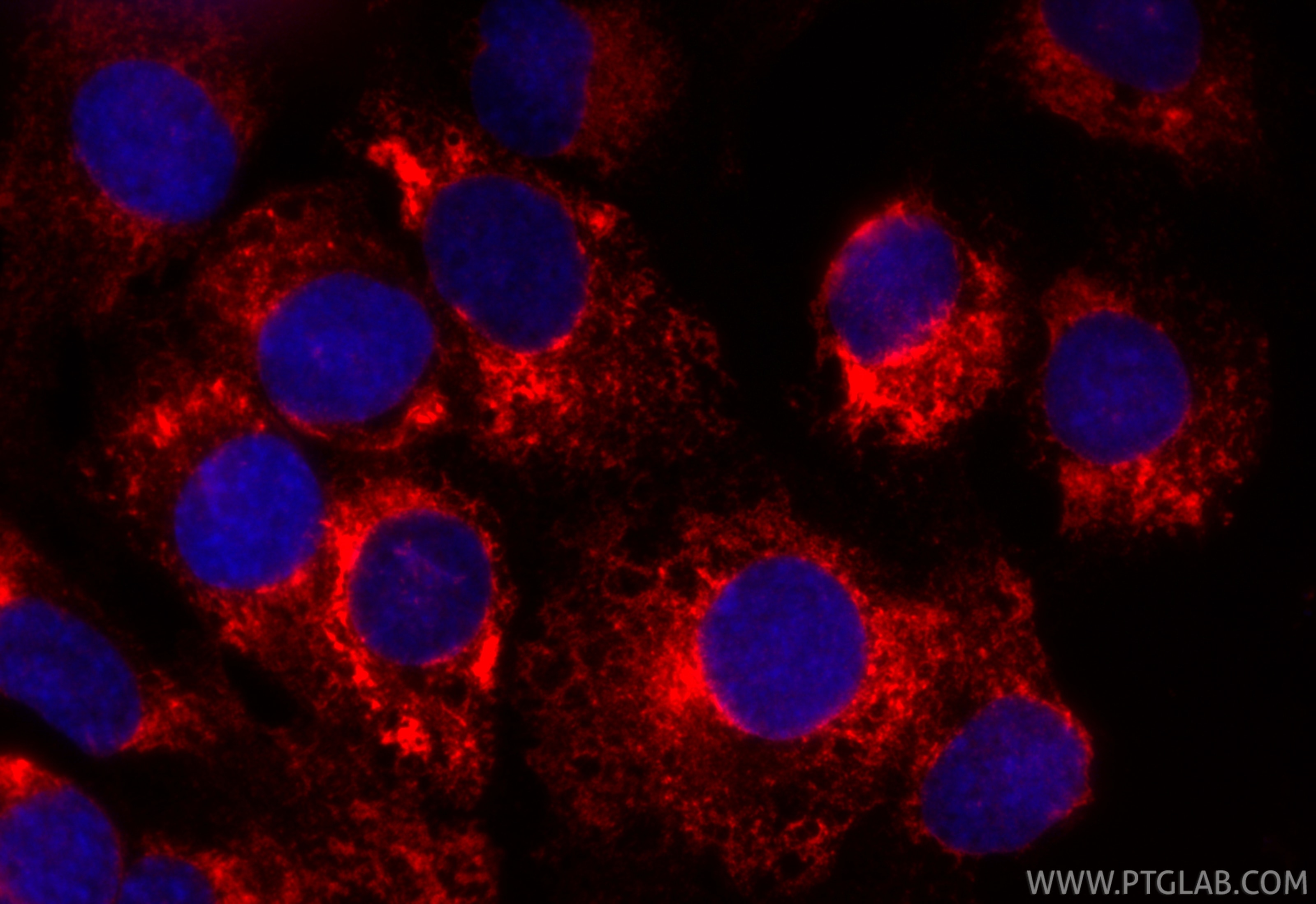 Immunofluorescence (IF) / fluorescent staining of SKOV-3 cells using CoraLite®594-conjugated KTN1 Recombinant antibody (CL594-85681-4)