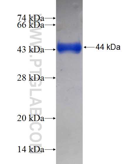 KTN1 fusion protein Ag13854 SDS-PAGE