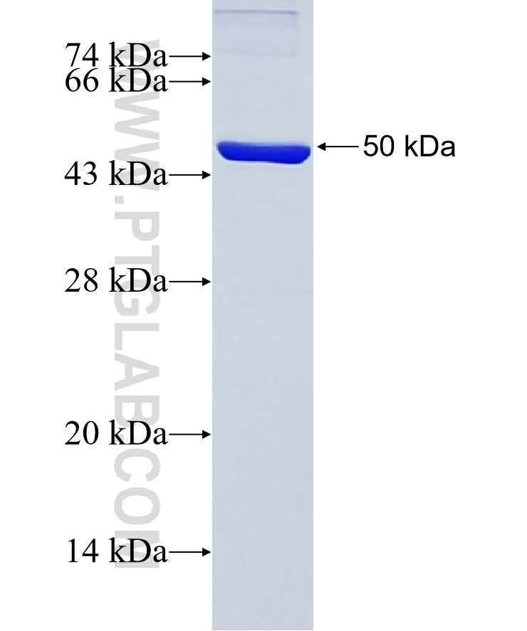 KTN1 fusion protein Ag13854 SDS-PAGE