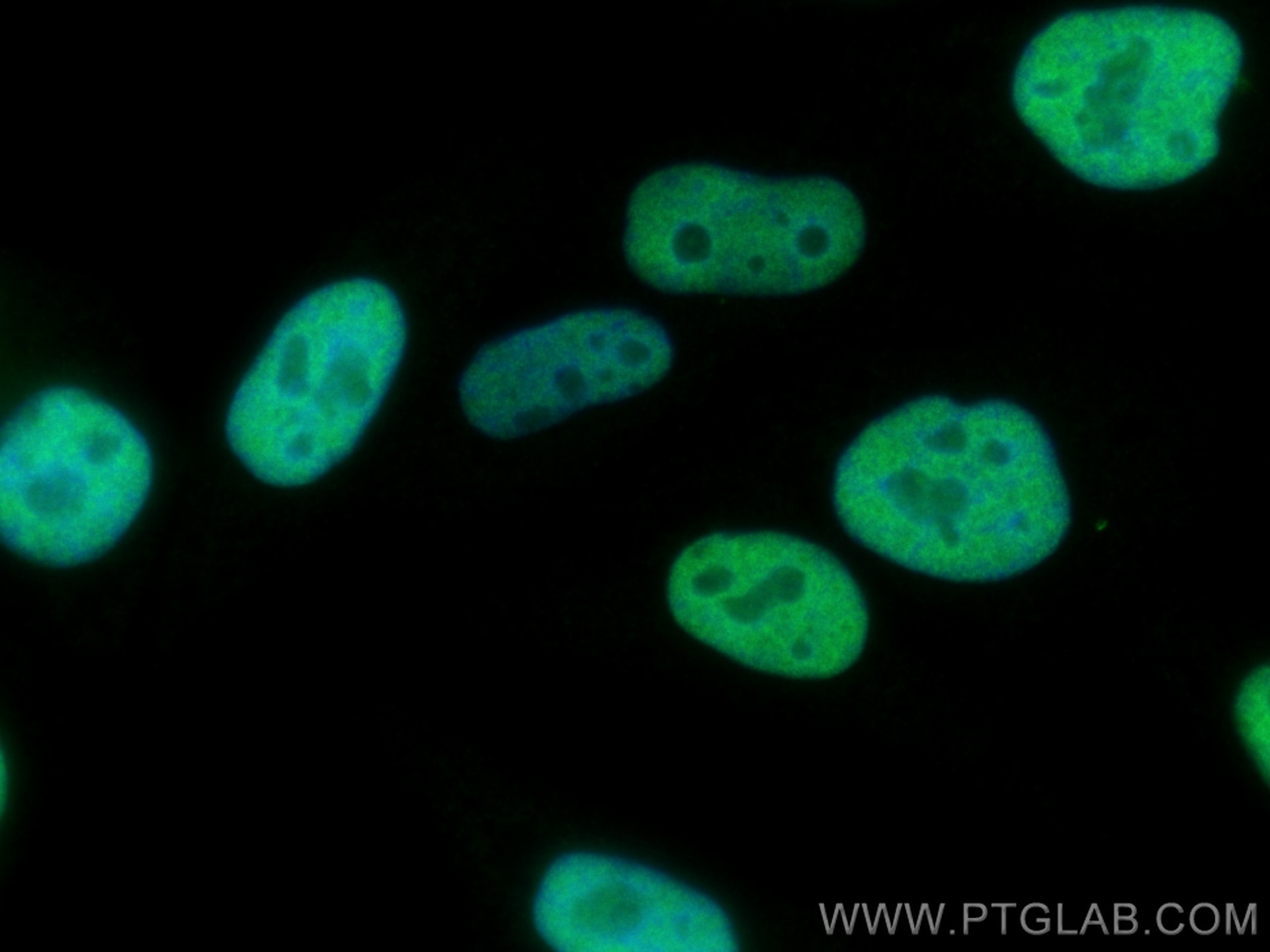 Immunofluorescence (IF) / fluorescent staining of HepG2 cells using KU70 Polyclonal antibody (10723-1-AP)