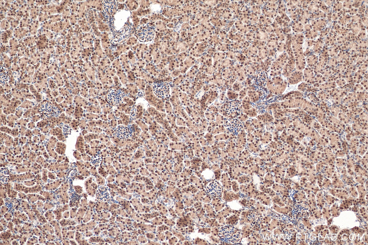 Immunohistochemistry (IHC) staining of mouse kidney tissue using KU70,XRCC6 Polyclonal antibody (10723-1-AP)