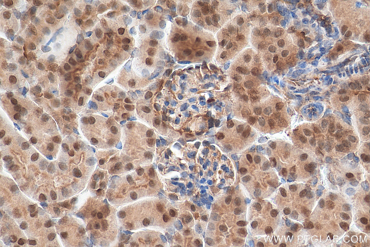 Immunohistochemistry (IHC) staining of mouse kidney tissue using KU70,XRCC6 Polyclonal antibody (10723-1-AP)